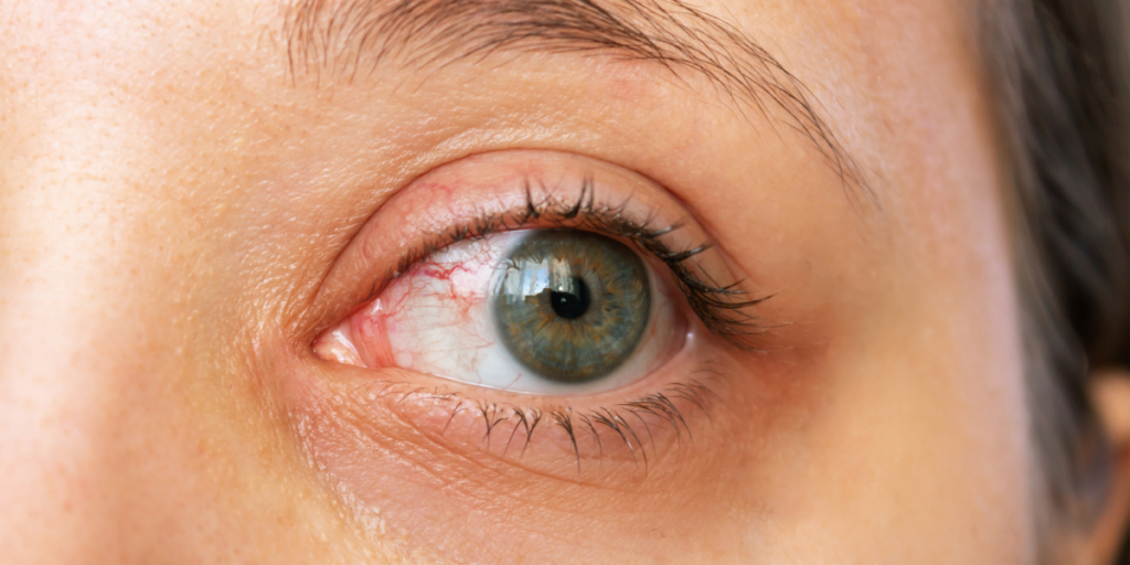 Top Features To Look For In The Best Heated Eye Masks For Dry Eyes