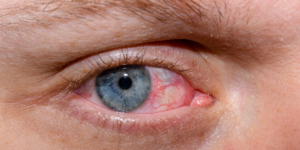 When And How To Use Heated Eye Masks For Dry Eyes